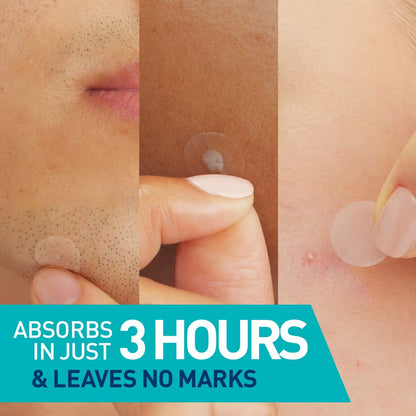 Blemish Barrier Patches - 22pz