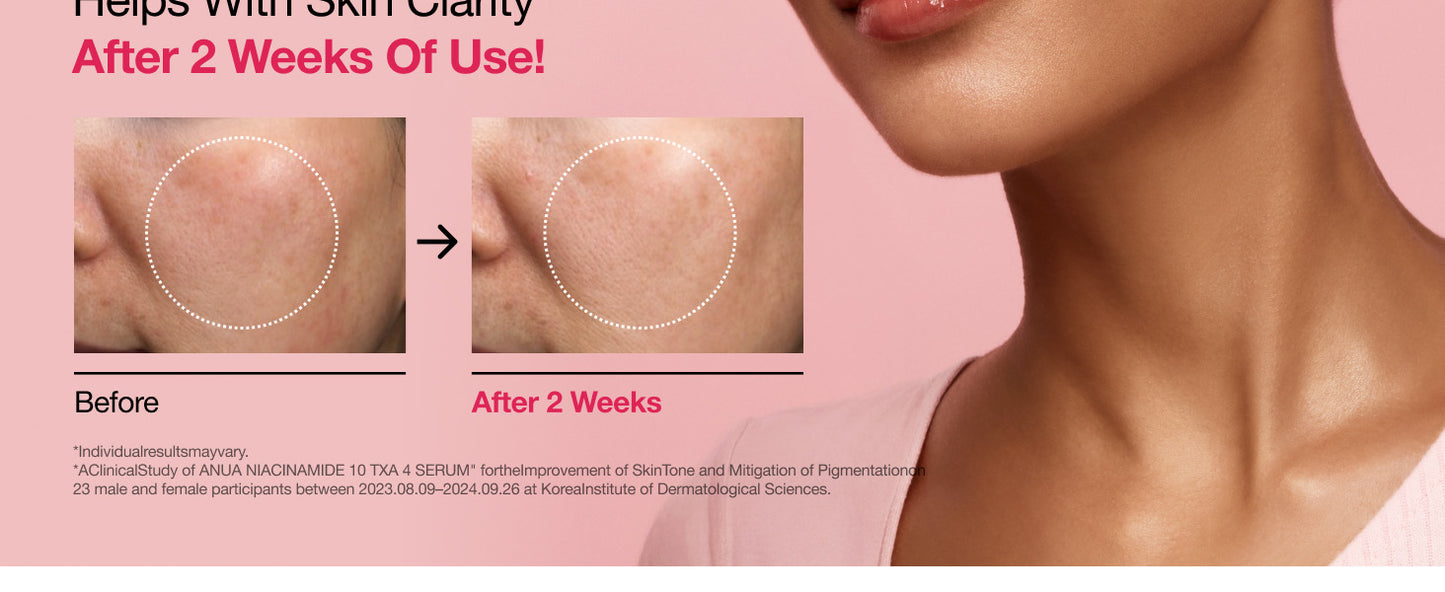 NIACINAMIDE10% + TXA 4% SERUM 30mL