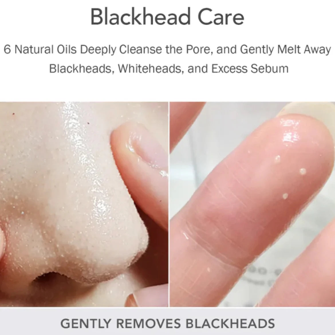 Fresh Blackhead Jojoba Cleansing Oil