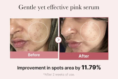 PDRN Pink Peptide Serum