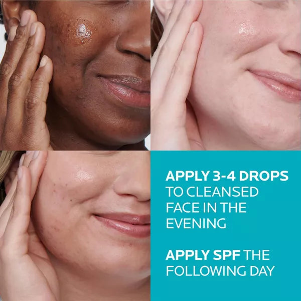 Acne Treatment Salicylic Acid Face Serum