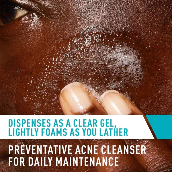 Acne Face Cleanser