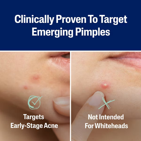 Fast Rescue Pimple Patch - 24pz
