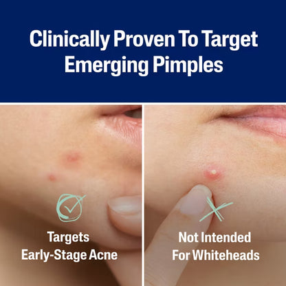 Fast Rescue Pimple Patch - 24pz