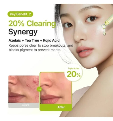 Azelaic Acid 10 Kojic Tea Tree Serum