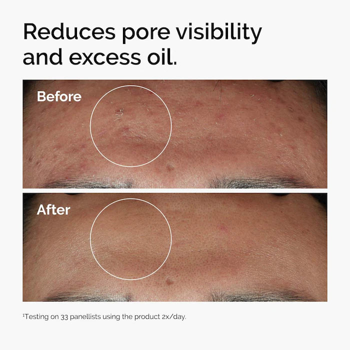Niacinamide 10% + Zinc 1%  Serum - 30ml