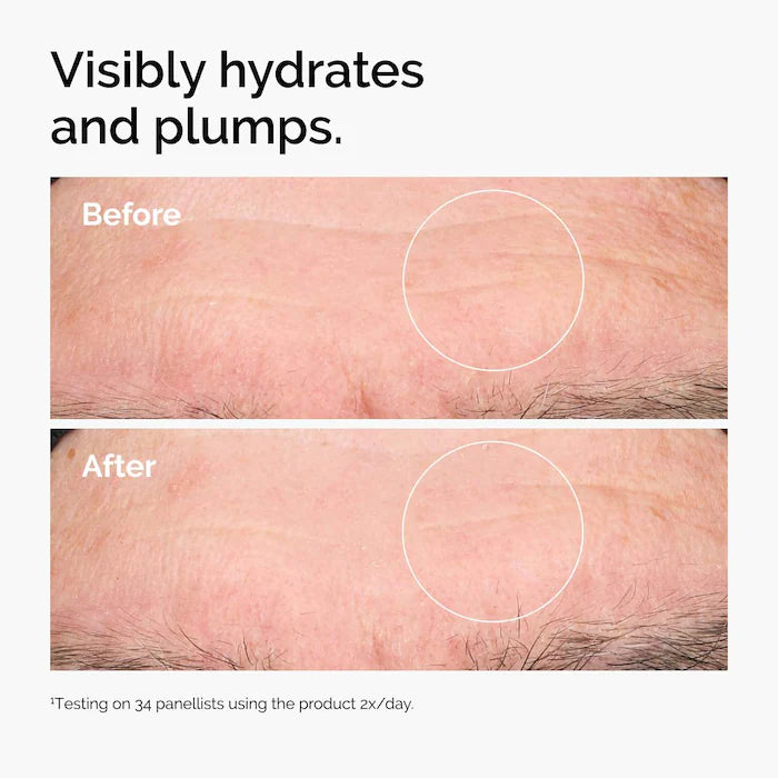 Hyaluronic Acid 2% + B5 Hydrating Serum
