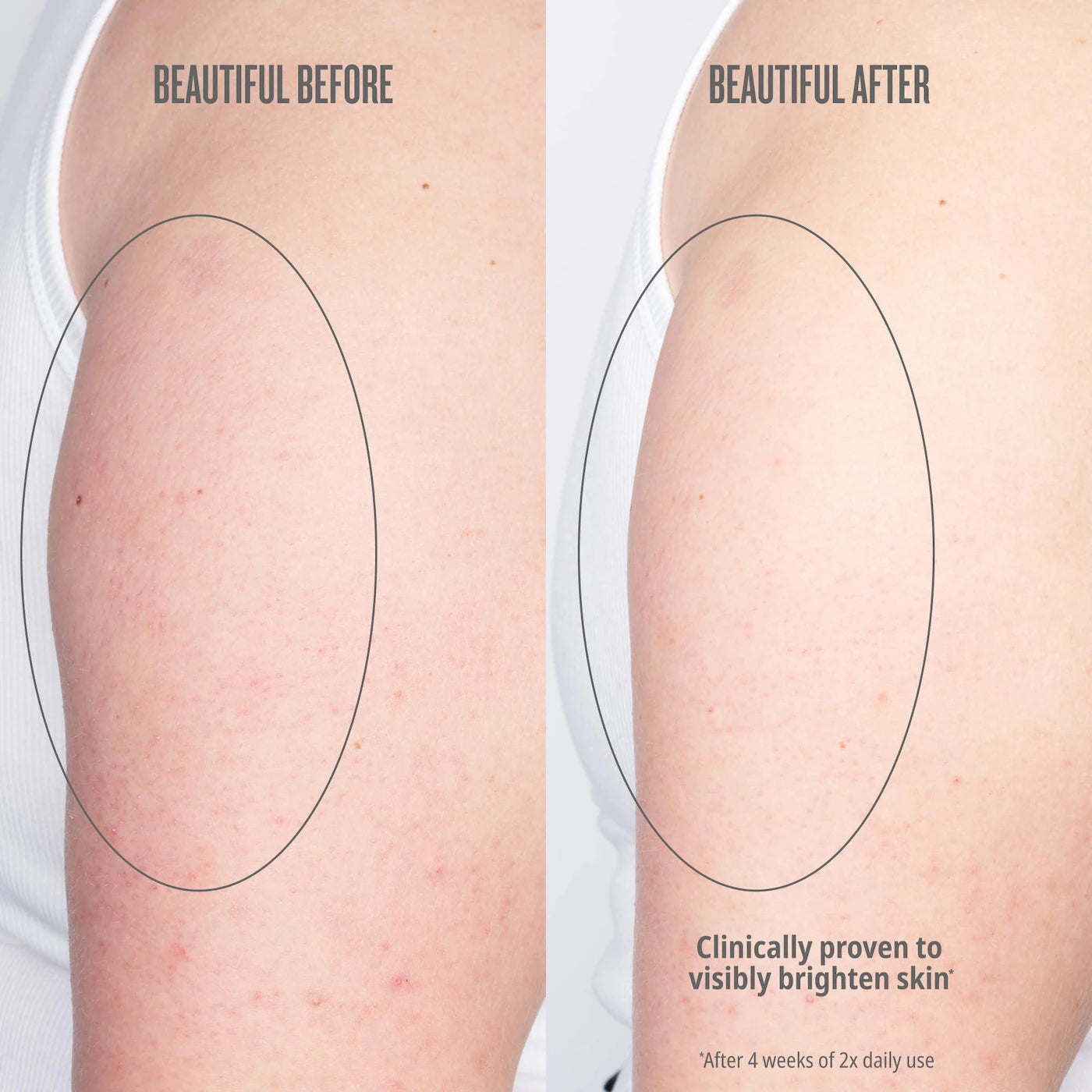 Bom Dia Bright™ Visibly Brightening and Smoothing Body Cream