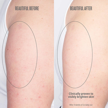 Bom Dia Bright™ Visibly Brightening and Smoothing Body Cream