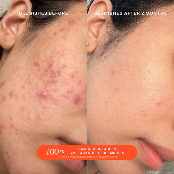 SOS Daily Rescue Facial Spray