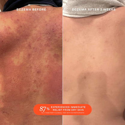 SOS Daily Rescue Facial Spray