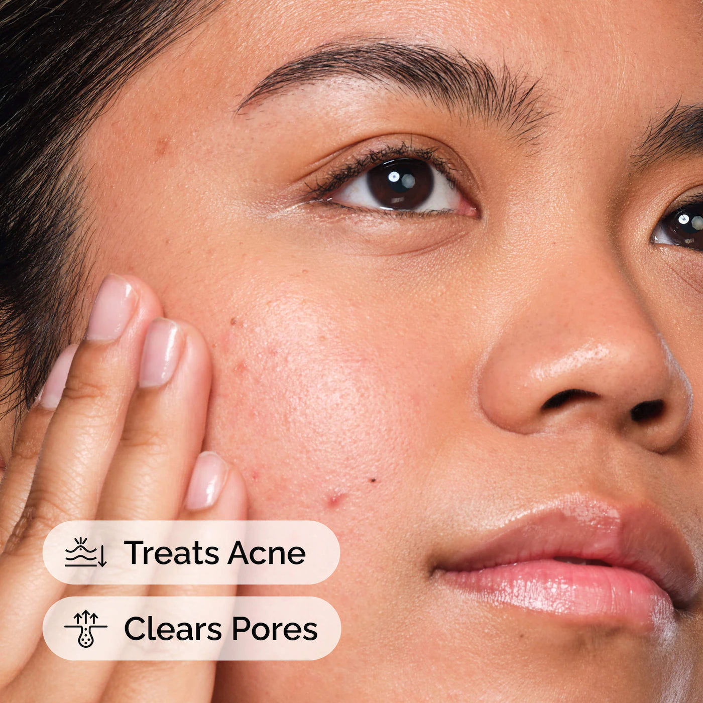 Salicylic Acid 2% Solution 30ml