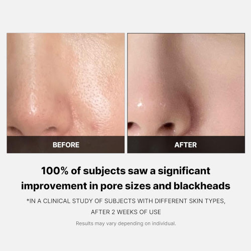 ZERO PORE PAD 2.0 70pcs